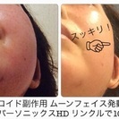 あらゆる肌悩みを解消！魔法の美容液！リンクルローションの画像