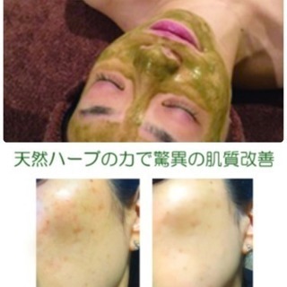 《美肌再生プログラム6回コース》剥けない❗️痛くない❗️当日お化...