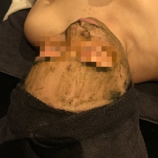 美肌再生】次世代ハーブピーリング