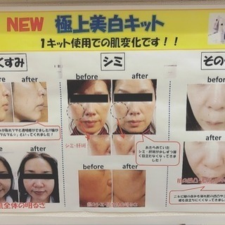 美白体験エステ♡モニター募集 - 北九州市