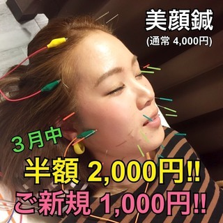 美顔鍼半額！ご新規の方は半額の半額、1,000円！