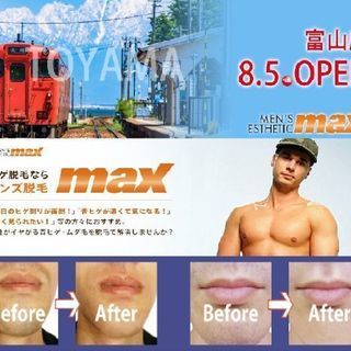 メンズ脱毛MAX富山店 - 美容