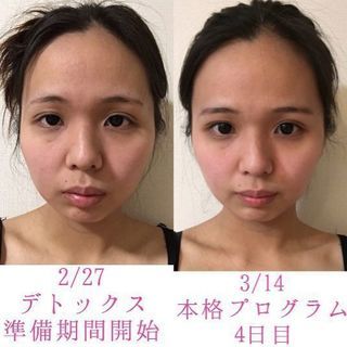 デトックス仲間募集💕✨ - 世田谷区