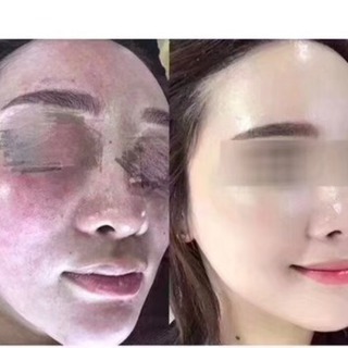 雪美人