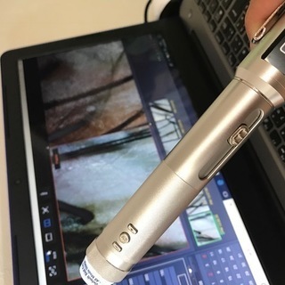 薄毛や抜け毛の改善、育毛、発毛を独自のSS療法で施術致します。発毛実績９８．７％！の画像