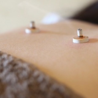 自宅で学ぶ！鍼灸師が教える温活セミナー
