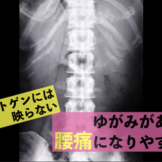 【渋谷区】レントゲンで問題なく3ヶ月以上続く腰痛は”腰痛専門”整形外科出身の代々木八幡なごみ整体院 - 地元のお店
