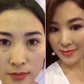 なんだか最近、目の下がたるんでない？