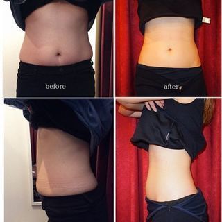 ≪薬剤師が教える≫便秘解消！1日5分セルフ腸もみ＆腸活ダイエットのコツ☆彡無料勉強会＆説明会の画像