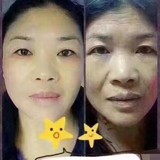 顔面の細胞を活性化し