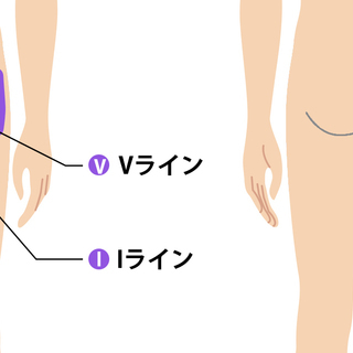 【ご新規様男性限定】ＶＩＯ脱毛モニター募集！好評につき再募集♪の画像