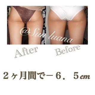 【痩身⚠️結果重視】1度の施術で最大－２cm‼️筋膜⚡️セルライ...