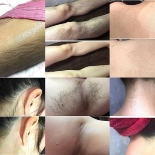知多半島 阿久比 男女OK♪ブラジリアンワックス脱毛サロン − 愛知県