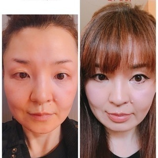 整形メイク