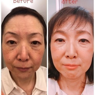 整形メイクの画像