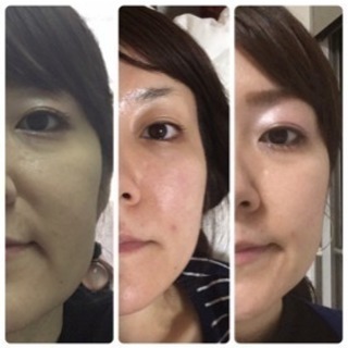 《顔痩せ・小顔・引き上げ》結果重視！写真は1回の施術例です✨まずは体験特別価格でお待ちしています❣️勧誘なし！ - 地元のお店