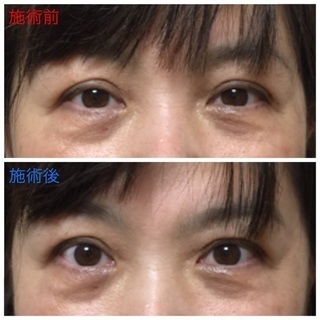 メイクのまま、お洋服を着たまま『きらら式＊小顔デザイン矯正講座 2日間集中コース』の画像