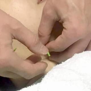 針灸整体で熟睡できた。という感想|札幌市豊平区中の島整体針灸院くらさろ − 北海道