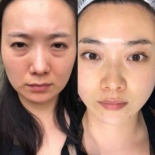 サーモシェイプの画像