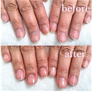 💅 ネイルケア✨2,000円 💅