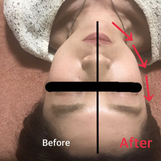 【比較写真撮影割引】施術前/後の写真撮影＆掲載(目隠しOK)で5...