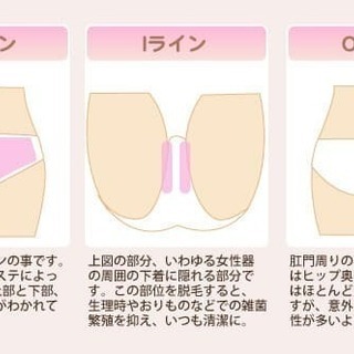 大人のデリケートゾーン脱毛¥1080〜