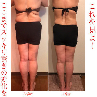 驚きの変化！ここまで痩せた 脚やせ専門サロン