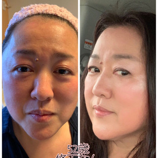 整形メイクしますの画像