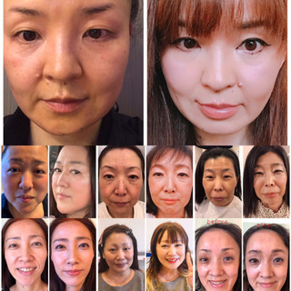 整形メイクします