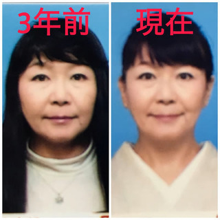 アップップメッソドレッスンでマイナス15歳の顔に♪の画像