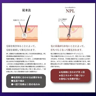 【大人気！ヒゲ脱毛】理容室だから気軽に来店！カットのついでにどうぞ！ − 千葉県