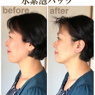 美肌メニュー超リフトアップ‼️セリサイト泡パック - 北九州市