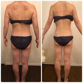 女性限定‼︎【すぐに使える】12月痩身エステ&リンパマッサージ講習の画像