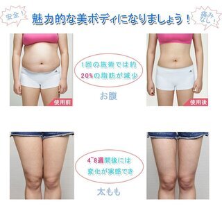 新品未開封　　キャビテーション 冷凍ダイエットマシンの画像