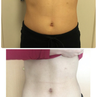 簡単痩身体験会(=^^=)の画像