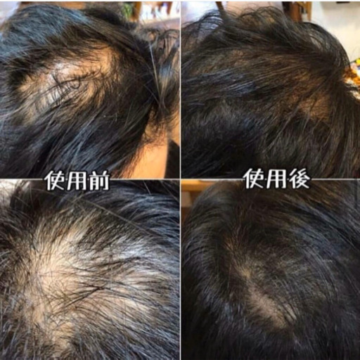 30%オフ　マトリックスエキススカルプケアシャンプー&コンディショナーセット