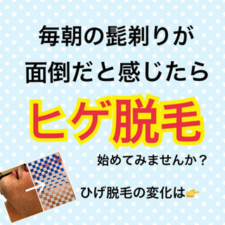 《毎朝の髭剃りとさようなら》　剛毛OK♪ヒゲ全体脱毛　通常￥18240→￥6980の画像