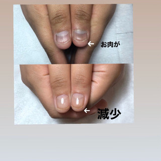 美爪に導く、深爪緩和&自爪育成サロン