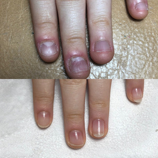 美爪に導く爪育成サロンの画像