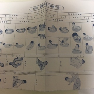 子どもの姿勢運動発達 早期診断／早期治療への道の画像