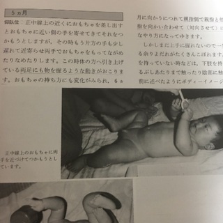 子どもの姿勢運動発達 早期診断／早期治療への道の画像