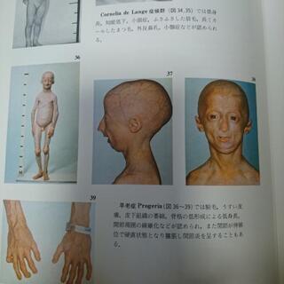 内分泌疾患カラーアトラスですの画像