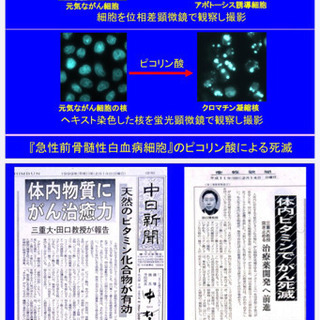 お財布の中が緊急事態の人に‼️の画像