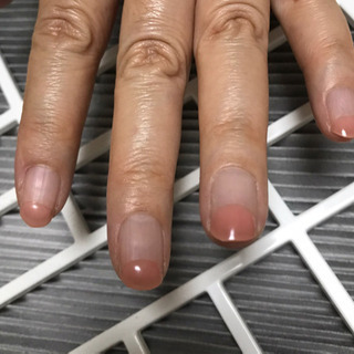[価格改正しました]最大4か月持ち！極限まで取れないフィルインレッスン