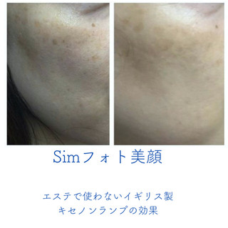 フォトフェイシャル無料チケット