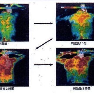 ゴルフで腰痛にもオススメ！！痛くない鍼灸のような効果で大満足！！