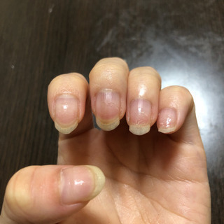 ジェルネイル、スカルプネイル練習台になります - 徳島市