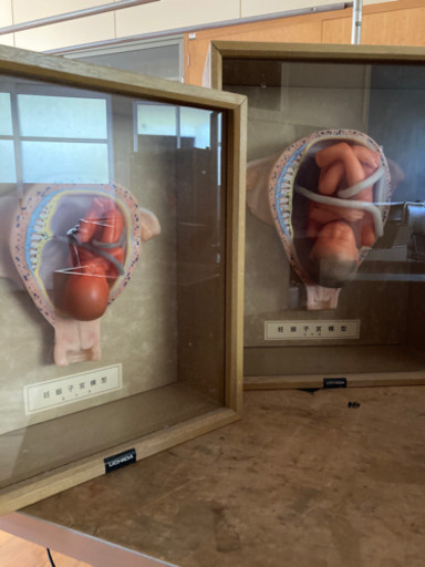 UCHIDA 妊娠子宮模型　お値段相談ください