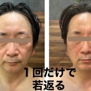 関西で大人気！　小顔になりながら若返る　「リジュベネーション」サ...
