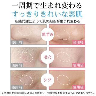 【新品・未使用】ウォーターピーリング 美顔器の画像